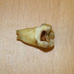 Dente de John Lennon Vai a Leilão por R$28 Mil Dente de John Lennon Vai a Leilão por R$28 Mil