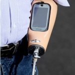 Prótese de Braço com Smartphone Embutido Prótese de Braço com Smartphone Embutido