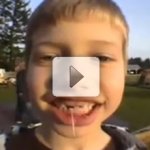 Extra��o de Dente com Foguete