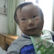 Bebê Chinês Nasceu com Máscara Natural