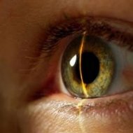Glaucoma - Saiba Mais Sobre Essa DoenÃ§a Silenciosa