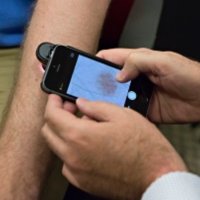 Cientista Cria App Para iPhone que Consegue Detectar Câncer de Pele