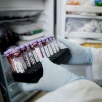 Britânicos Criam Teste Simples Para Detectar Câncer ou HIV