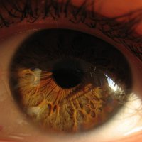 O que é o Glaucoma?