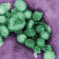 Isolado Vírus da Influenza A, Mais Conhecida Como Gripe Suína