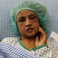 Adolescente AfegÃ£ Relata Meses de Tortura nas MÃ£os de Marido e Sogros