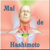 Mal de Hashimoto, DoenÃ§a Autoimune