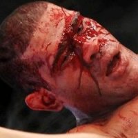 AtÃ© Quando VÃ£o Valer as Cotoveladas no UFC?