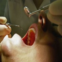 Dentista Pode Ter Infectado Mais de 22 Mil Pessoas com o VÃ­rus Hiv,