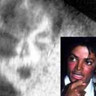 Michael Jackson Aparece em Ultrassonografia